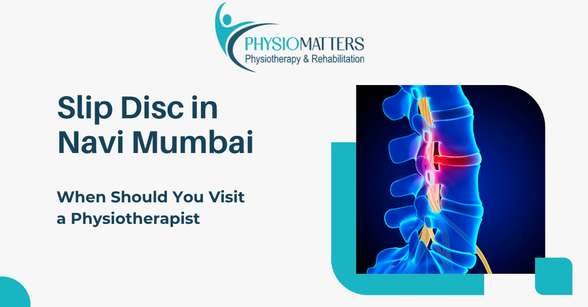 Best Physiotherapy Treatment for Slip Disc in Navi Mumbai | Physio Matters Vashi