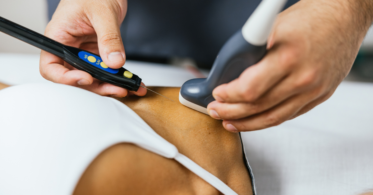 Dry Needling vs Myofascial Release Physiotherapy in Navi Mumbai