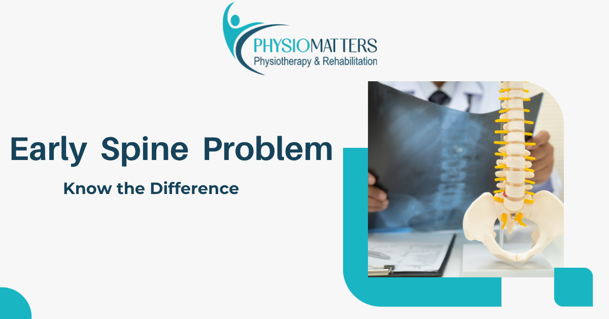 Why IT Professionals Develop Early Spine Problems | Physio Matters Vashi